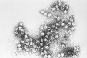 Un enterovirus vist pel microscopi