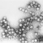 El que cal saber dels enterovirus